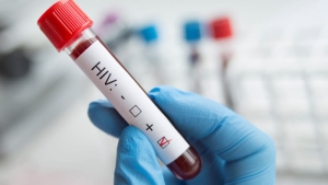 Gracias a un tratamiento novedoso mujer se cura de VIH a través de sangre umbilical