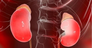 Día Mundial del Riñón: Estas son las dudas más comunes sobre la insuficiencia renal crónica