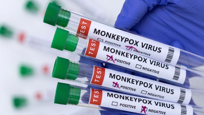 Europa autoriza el uso de la vacuna Imvanex contra viruela simica